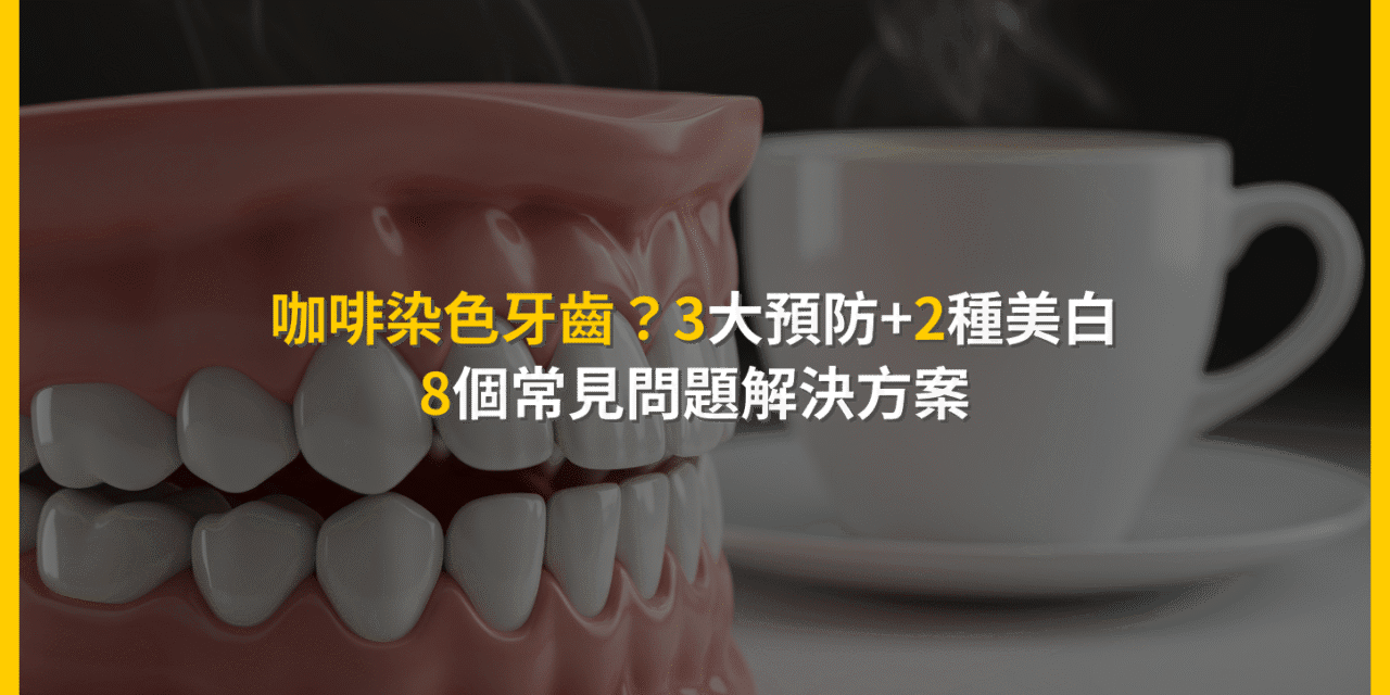 咖啡染色牙齒？3大預防+2種美白：8個常見問題解決方案